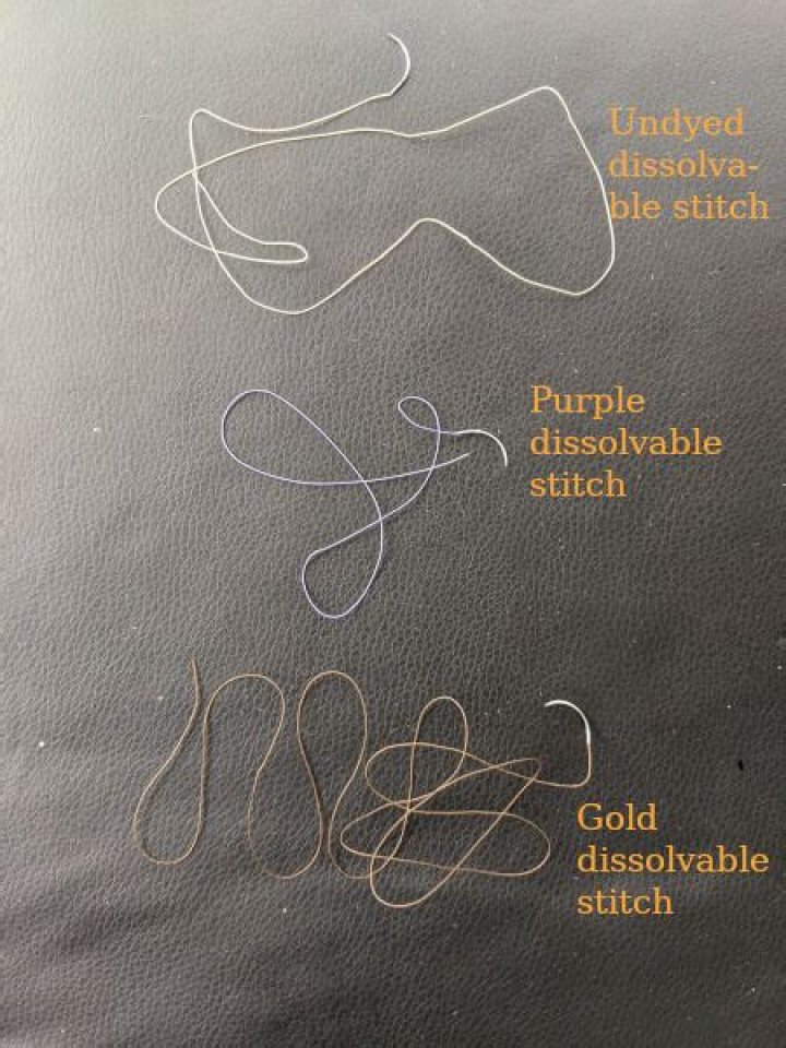 How Long For Dissolvable Stitches To Dissolve