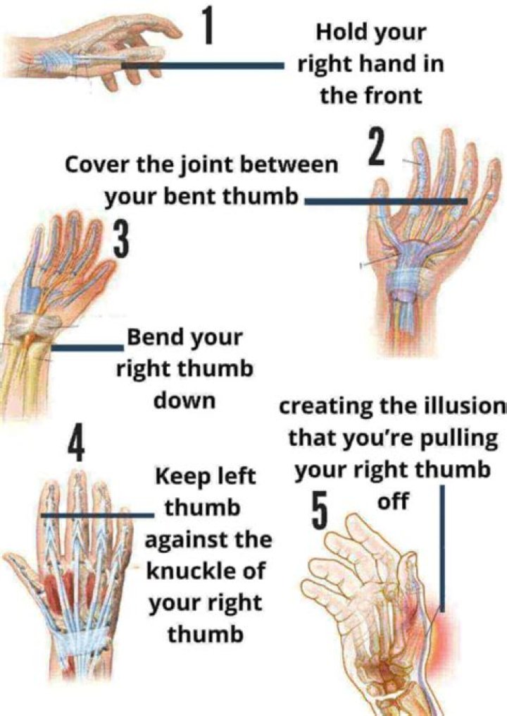 How To Crack Thumb