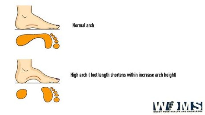 Question: How To Make Feet Narrower