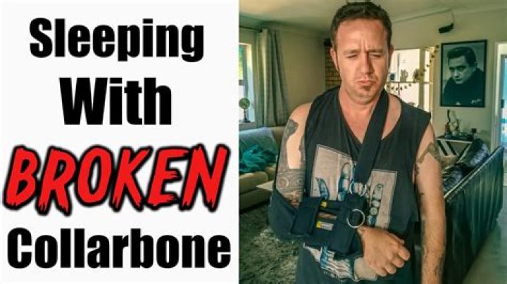 Question: How To Sleep With A Broken Collarbone