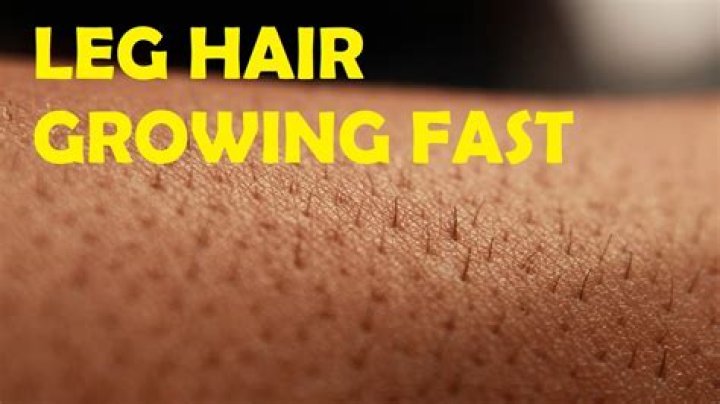 Question: Why Do My Legs Itch When I Shave