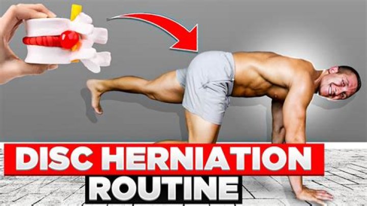 Quick Answer: Can I Ride A Stationary Bike With A Herniated Disc