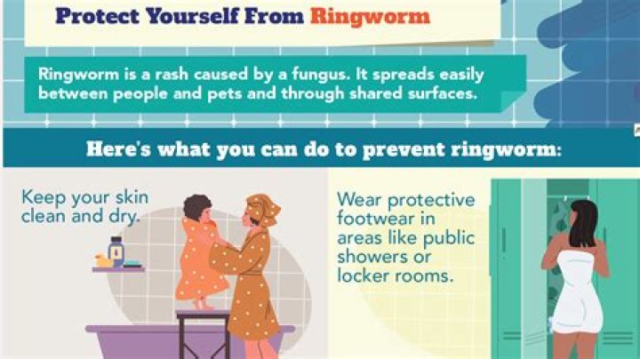 Quick Answer: Can You Get Ringworm From Camping