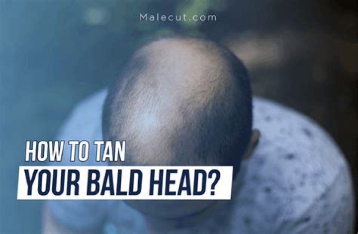 Quick Answer: How To Tan Bald Head