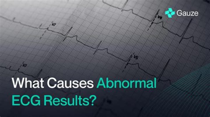 Quick Answer: What Does A Bad Echocardiogram Look Like