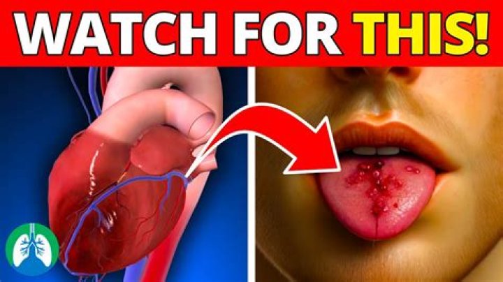 Quick Answer: Why Does My Cough Taste Like Blood