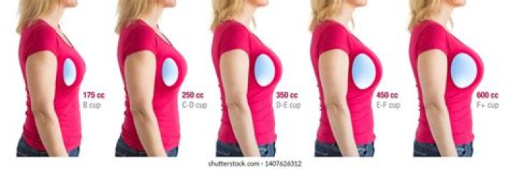 What Does An I Cup Look Like