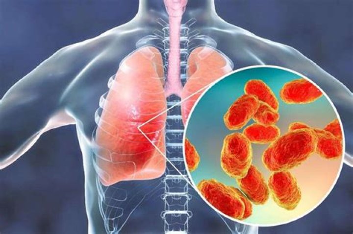 What is tracheitis